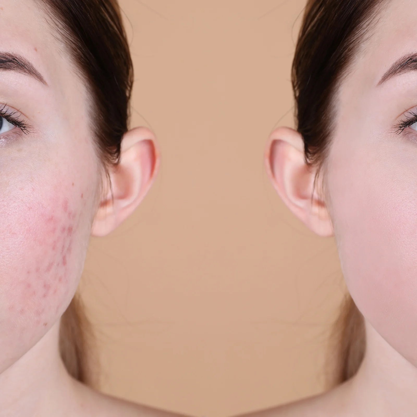 Spot Repairing Serum